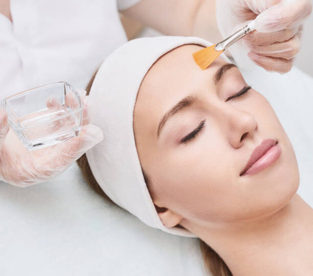 Chemical-Peels-in-Riyadh-26