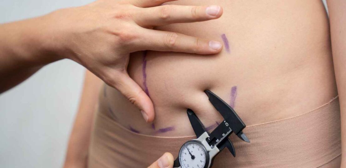 bariatric-surgery-in-islamabad